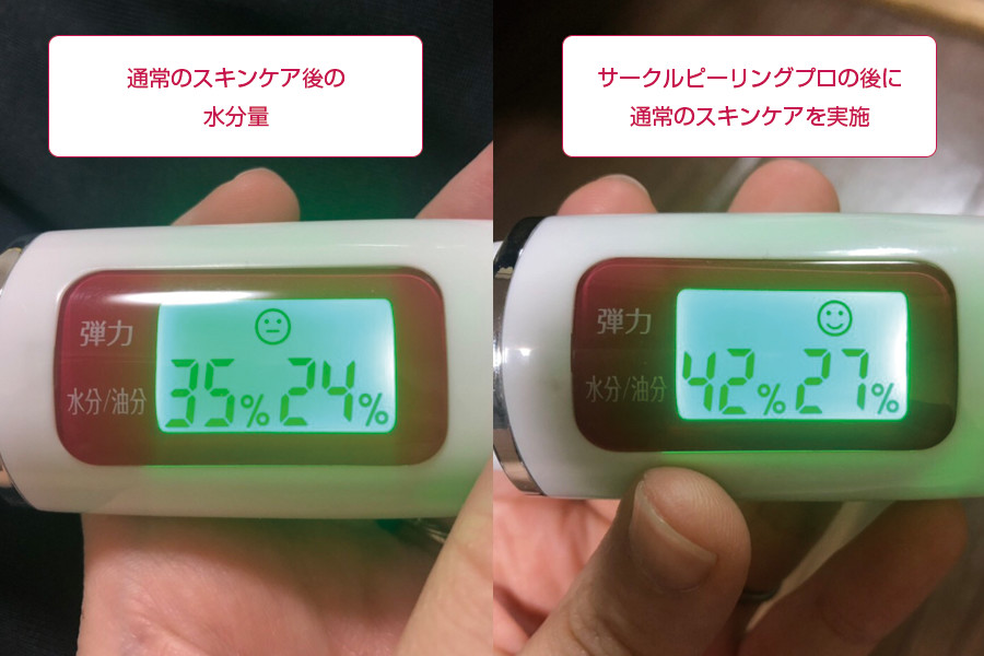 サークルピーリングプロ(肌の水分量)